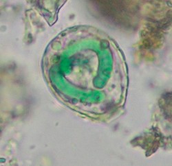 Sladkovodní krytenka Paulinella chromatophora ze skupiny Euglyphida (Rhizaria) obsahující dva modrozelené útvary – chromatofory, které představují endosymbioticky žijící redukované sinice (blíže v textu). Na obrázku je dobře viditelná křemičitá schránka krytenky. Foto T. Hauer / © Foto T. Hauer