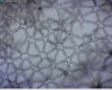 Detail aerenchymu sítiny,  zvětšení 400krát. Jde o typ charakteristický hvězdicovitými buňkami. Foto P. Šíma