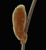 Vajíčko (hnida) vši dětské (Pediculus capitis) připevněné samicí při kladení  na lidský vlas. Larvální stadium  po vylíhnutí z vajíčka prochází třemi  instary, z posledního se líhne dospělý jedinec. SEM, kolorováno. Foto J. Bulantová