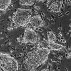 Kolonie prasečích iPS buněk kultivovaná na podpůrných myších fibroblastech. Foto P. Vodička