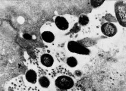 Bakterie Escherichia coli přisedající k poškozené buňce střevní výstelky. Její geny virulence byly získány horizontálním přenosem. Elektronová mikroskopie, zvětšení 10 000x. Foto I. Trebichavský / © I. Trebichavský
