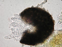 Phaeocryptopus gaeumannii –  prasklé pseudotecium a z něj částečně uvolněná plná vřecka s askosporami. Zvětšení 1 000×. Foto D. Palovčíková