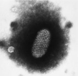 Virion poxviru. Příbuzný poxvirus – virus pravých neštovic (Variola) je těžký lidský patogen, který patrně pochází z Asie, odkud se postupně dostal na všechny kontinenty a má na svědomí smrt stamilionů lidí. Díky systematickému očkování byl vymýcen. Poxviry se zdály být strukturou, velikostí i replikační stra- tegií výjimkou mezi viry. Nyní je jejich čeleď Poxviridae řazena k velkému množství různých, nedávno objevených velkých virů seskupených prozatím do čeledí Ascoviri- dae, Asfarviridae, Iridoviridae, Marseilleviridae, Megaviridae, Pandoraviridae, Phycodnaviridae, Pithoviridae a Poxviridae. Je pro ně navržen řád Megavirales. Foto H. M. Lairdová