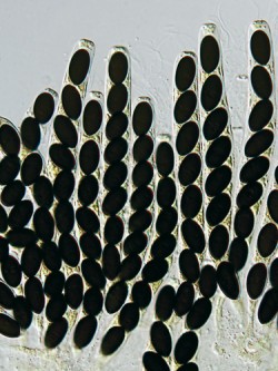 Tmavé oválné askospory hnojenky výkalové (Sordaria fimicola) seřazené v jedné řadě ve vřecku s drobným askoapikálním aparátem. Tento druh houby tvoří lahvicovité plodnice typu peri­tecium na trusu býložravců. Foto O. Koukol 