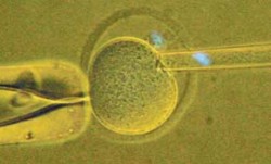 Postup přípravy cytoplastu, který poslouží jako příjemce jádra. Vřeténko je nasáto enukleační pipetou (vřeténko s chromozomy a polární tělísko jsou zbarveny modře). Foto J. Fulka / © J. Fulka
