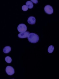 Jádra buněk ječmene setého (obarvená fluorescenčním barvivem DAPI). Velikost jader ca 10 μm. Foto B. Petrovská