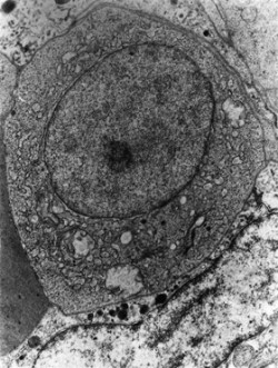 Velký lymfocyt pronefrosu (párového vylučovacího orgánu) hrouzka obecného (Gobio gobio). Zvětšení v elektronovém mikroskopu   20 000×. Lymfocyty mají specifické receptory pro antigen a objevily se poprvé u čelistnatých obratlovců. Foto I. Trebichavský  / © Photo I. Trebichavský