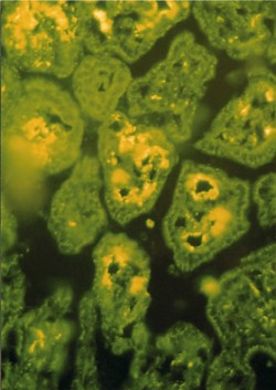 Molekuly HSP70 (proteiny tepelného šoku – Heat Shock Proteins), které  vznikly při salmonelové infekci, jsou v histologickém řezu střevních klků obarveny fluorescencí. Tyto stresové  proteiny jsou rozpoznávány pomocí buněčných receptorů TLR 2 a TLR 4 (zvětšeno 200×). Blíže v textu.  Foto I. Trebichavský  / © Photo I. Trebichavský