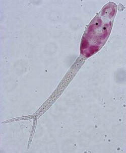 Schistosomiasis mansoni, Anticorpi anti Schistosoma mansoni IgG - Detalii analiza | Bioclinica
