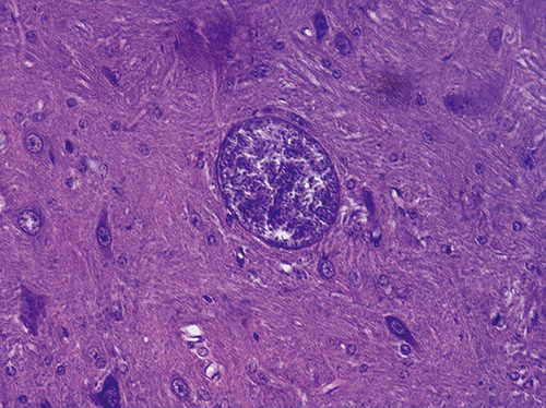 Toxoplasma parazita a férgek tünetei felnőttkorban mint a kezelésre