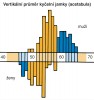 Distribuce jednotlivých rozměrů kostry a princip klasifikace podle pohlaví. Variace jednoho či dvou rozměrů se statisticky významným pohlavním rozdílem, který má širokou zónu překrývání hodnot a pouze okrajové hodnoty u obou pohlaví (označené modře) se ne­vyskytují u opačného pohlaví (pouze 9 žen má rozměr acetabula menší, než nacházíme u mužů, avšak přibližně jedna třetina mužů má daný rozměr větší než ženy; tento parametr by tak mohl správně odhadnout pohlaví jen u méně než poloviny celého souboru). Jeden rozměr tedy nedovoluje úspěšný a spolehlivý odhad pohlaví – musíme využít několik rozměrů současně a statistické metody  klasifikace. Orig. M. Chumchalová, upraveno podle výsledků J. Brůžka (1981, rozměry stydké kosti a acetabula odpovídají reálné situaci v souboru jedinců známého pohlaví jedné evropské populace a princip klasifikace je pouze vyjádřením principu a neodpovídá reálným hodnotám příkladu obou rozměrů)