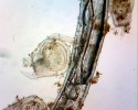 Měchýřky bublinatek – bublinatka srstnatá (U. hirta) ze sekce Meionula. Foto J. Franta a M. Spousta