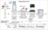 Sledování inhibice CK1ε metodou western blot, která se využívá pro detekci konkrétního proteinu ve vzorku. Elektroforézou dojde k rozdělení proteinů podle velikosti, poté jsou přeneseny z gelu na membránu a detekovány pomocí specifických protilátek (horní část obr.). Upraveno podle: B. T. Kurien a R. H. Scofield (2015). Aktivní fosforylovaná forma CK1ε  je označena červenou šipkou (spodní část obr.). Po přidání inhibitorů A a B dochází k úbytku fosforylované formy a k blokaci její autofosforylační aktivity. Inhibitor C aktivitu CK1ε neovlivňuje. Orig.: M. Gregorová