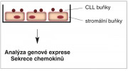 Schematické znázornění společné kultivace leukemických a stromálních buněk a následná analýza genové  exprese nebo sekrece chemokinů. Orig.: M. Gregorová
