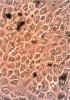 Primární buňky pigmentového epitelu sítnice (Retinal Pigmented Epithelium, RPE) kultivované in vitro (zvětšení 20×). Šipky ukazují na pigmentová zrna (melanin), která jsou typická pro pigmentový epitel sítnice. Foto K. Vodičková Kepková