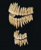 Pohled ze strany na stálou dentici člověka (nahoře) a dočasnou neboli mléčnou dentici (dole). Převzato z učebnice zubního lékařství Gustava Preiswerka Zahnheilkunde (1919)