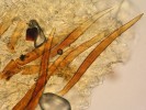Tlustostěnné a zašpičatělé chlupy kosmatky bradavčitovýtrusé (Scutellinia pseudotrechispora). Foto M. Šandová