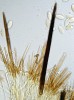 Štětinatka jehlicová (Desmazierella acicola) – světle hnědé vrcholy parafýz vyčnívající nad vřecka a tmavší útvary čnějící z hymenia, tzv. hymeniální sety. Foto O. Koukol 