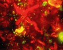 Roztlakový preparát exkrementu  pancířníka Damaeus onustus ve fluorescenčním světle: červené větvené vlákno – strávená houba, svítivě zelené body – živé bakterie. Barvení Orange G. Foto Jaroslav Smrž