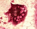 Pancířník Hermannia gibba –  na obr. hemocyt (volně pohyblivá buňka)  s vakuolami. Massonův trichrom. Foto Jaroslav Smrž