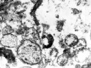 Bakteriální těleso blízko střeva  u zákožkovce T. putrescentiae  s bakteriemi Serratia marcescens.  Při obarvení: v prozařovacím (transmisním) elektronovém mikroskopu (TEM). Foto Jaroslav Smrž