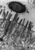 Bakterie na řasinkách střevní buňky. Normální střevní mikroflóra tlumí produkci zánětových cytokinů, které indukují patogenní mikroby. Snímek z elektronového mikroskopu, zvětšení 20 000×. Foto I. Trebichavský