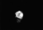 Makrofág z povrchu nitroděložního tělíska Dana. Cytokin TNF alfa je prokázán v cytoplazmě buňky fluorescencí. TNF alfa vyvolává chronický zánět,  který snižuje pravděpodobnost  otěhotnění. Zvětšení 3 000×. Foto I. Trebichavský