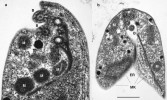 Podélný (obr. a) a příčný (b) průřez přední částí buňky bičíkovce  Pseudoharpagon pertyi (Excavata:  Discoba: Heterolobosea) s částečně zachovanou exkavátní morfologií.  Jediný mikrotubulární kořen (MK),  rozdělený na několik částí,  u skupiny Heterolobosea podpírá celou exkavátní rýhu (ER). M – anaerobní  mitochondrie, J – jádro, B – příčné  průřezy různých částí bičíků,  RH – cytoskeletární struktura rhizoplast. Transmisní elektronová mikroskopie. Měřítko 500 nm (pro obr. a)  a 1 μm (pro obr. b). Foto T. Pánek