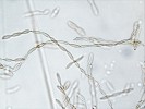 Jedna z „tváří“ chlupečky jehlicové (Cistella acuum) – řetízky konidií produkovaných v kultuře po izolaci jako endofyt  z jehlic smrku ztepilého (Picea abies). Foto Z. Haňáčková