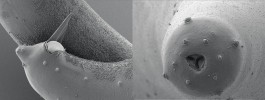 Detail těla samce obří generace  nového druhu hlístovky Steinernema ethiopiense.  Vlevo ocasní část se spikulami  (jehlice, které slouží k uchycení  samečka na samičku při páření),  vpravo hlavová část s otevřeným  ústním otvorem a papilami.  Spikuly i počet a rozmístění papil  jsou důležitými determinačními znaky  většiny hlístic, nejen hlístovek.  Foto Z. Mráček