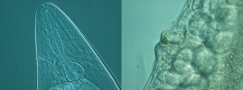 Samice hlístovky S. intermedium, přední část těla s jícnem  a exkrečním pórem na levé straně  při povrchu těla (vlevo) a vulva  s oválnými vajíčky (vpravo).  Foto Z. Mráček