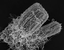 Na rozvětvených konidioforech Metarhizium anisopliae  vyrůstají řetízky konidií a tvoří nápadné sloupce (snímek ze skenovacího elektronového mikroskopu). Foto A. Kubátová