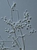 Shluk konidiogenních buněk houby Beauveria bassiana, na jejichž konci se střídavě tvoří drobné konidie. Foto A. Kubátová