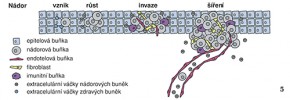 Extracelulární váčky u nádorového bujení se účastní všech fází vývoje nádoru. Při jeho vzniku okolní zdravé buňky sekretují váčky obsahující miRNA, které potlačují růst nádoru. Nádorové buňky mohou této inhibici růstu uniknout a dále se množit. Váčky pocházející z nádorových buněk mohou také do okolních buněk šířit poškozené geny podporující množení buněk. Váčky nádorových buněk působí na fibroblasty, které sekrecí cytokinů podporují další množení nádorových buněk a zároveň odbouráváním okolní mezibuněčné hmoty vytvářejí  prostor pro růst nádoru. Pokud je okolní prostředí hypoxické, váčky nádorových buněk a fibroblastů podporují dělení buněk endotelu (cévní výstelky) a růst nových cév. To umožňuje další šíření nádoru a tvorbu metastáz. Orig. H. Kupcová Skalníková