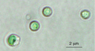Izolované chloroplasty z řasy Cyanidioschyzon merolae. Foto R. Aoki a S. Matsunaga