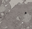 Ultrastrukturální analýzy izolovaných a začleněných chloroplastů v savčích buňkách v elektronovém mikroskopu. Stejná oblast, která byla zkoumána fluorescenční mikroskopií. Degenerované chloroplasty v buňkách CHO-K1 čtvrtý den po společné kultivaci, měřítko 3 μm. Bílé šipky ukazují chloroplasty, Nu – jádro, Mt – mitochondrie. Foto R. Aoki a S. Matsunaga