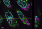 Snímek ze superrozlišovací fluorescenční mikroskopie buněk CHO-K1, savčí linie odvozené z vaječníků křečíka čínského (Cricetulus griseus), které pohltily chloroplasty, po společné kultivaci, den 0. Buněčné membrány barveny pomocí FM1-43 (zeleně), jádra barvená DAPI (modře). Chloroplasty vizualizovány autofluorescencí (fialově). Foto R. Aoki a S. Matsunaga