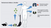 Schéma průběhu hantavirové infekce u člověka. K nákaze nejčastěji dochází vdechnutím aerosolu kontaminovaného výměšky infikovaných hlodavců. Hantaviry Starého světa způsobují hantavirovou hemoragickou horečku, nebo její mírnější formu označovanou jako nephropathia epidemica, zatímco hantaviry Nového světa mají za následek především postižení plic (hantavirový plicní syndrom). Orig. J. Kamiš
