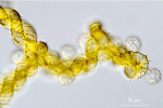 Spory a hygroskopická vlákna kapilicia vlasenky plazivé (Hemitrichia serpula). Spory mají nápadnou síťovitou strukturu a průměr asi 10 μm. Kapilicium je spirálně ornamentované. Foto O. Koukol