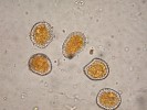 Žluté aeciospory puchýřnatky podbělové (Coleosporium tussilaginis). Zvětšení 600×. Foto D. Palovčíková