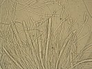 Sypavka borová (Lophodermium pinastri). Kyjovité útvary jsou vřecka, uvnitř obsahující niťovité askospory, v okolí vřecek delší vlákna nazývaná parafýzy. Zvětšení 600×. Foto D. Palovčíková