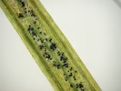 Plodnice (pseudotecia) švýcarské sypavky douglasky Phaeocryptopus  gaeumannii na rubu zelené jehlice v místě průduchů druhý rok  po proniknutí nákazy. Foto D. Palovčíková