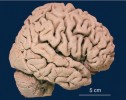 Mozek člověka (Homo sapiens). Foto O. Naňka, Anatomický ústav 1. lékařské fakulty UK v Praze