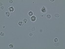 Hemocyty zavíječe voskového – v mikroskopu můžeme pozorovat různé typy volných buněk, zejména granulocyty (výrazná zrnka uvnitř buňky)  a plasmatocyty (mění tvar – vytvářejí panožky a mohou přilnout k povrchu). Foto P. Hyršl
