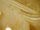 Černé nodule (blíže v textu) ve tkáni housenek zavíječe voskového. Po injikaci bakterií do tělní dutiny housenek byly rozpoznány, obaleny hemocyty a následně nodule melanizovány. Foto P. Hyršl