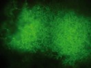 Průkaz hyf mukormycetů ze vzorku plicní tkáně ve fluorescenčním mikroskopu po obarvení blankoforem. Foto P. Lysková