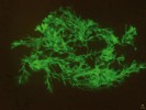 Průkaz hyf mukormycetů ze vzorku plicní tkáně ve fluorescenčním mikroskopu po obarvení blankoforem. Foto P. Lysková