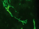 Průkaz hyf náležejících  zástupci rodu kropidlák (Aspergillus)  ve vzorku hrudního punktátu ve fluorescenčním mikroskopu po obarvení blankoforem. Foto  M. Kolařík