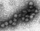 Virus West Nile způsobující západonilskou horečku. Snímek z elektronového mikroskopu. Foto C. Goldsmith  z amerického Centers for Disease Control and Prevention (CDC),  s laskavým svolením