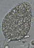 Zoosporangium plísně olšové (Phytophthora alni). Blíže v textu. Foto K. Černý
